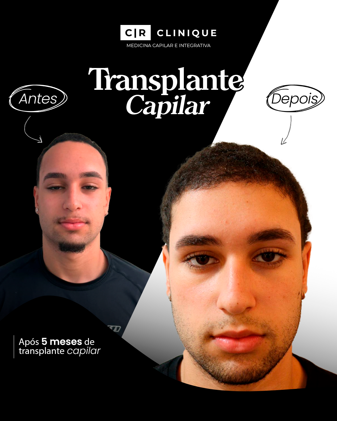 Foto de Caina, cliente da CR Clinique.