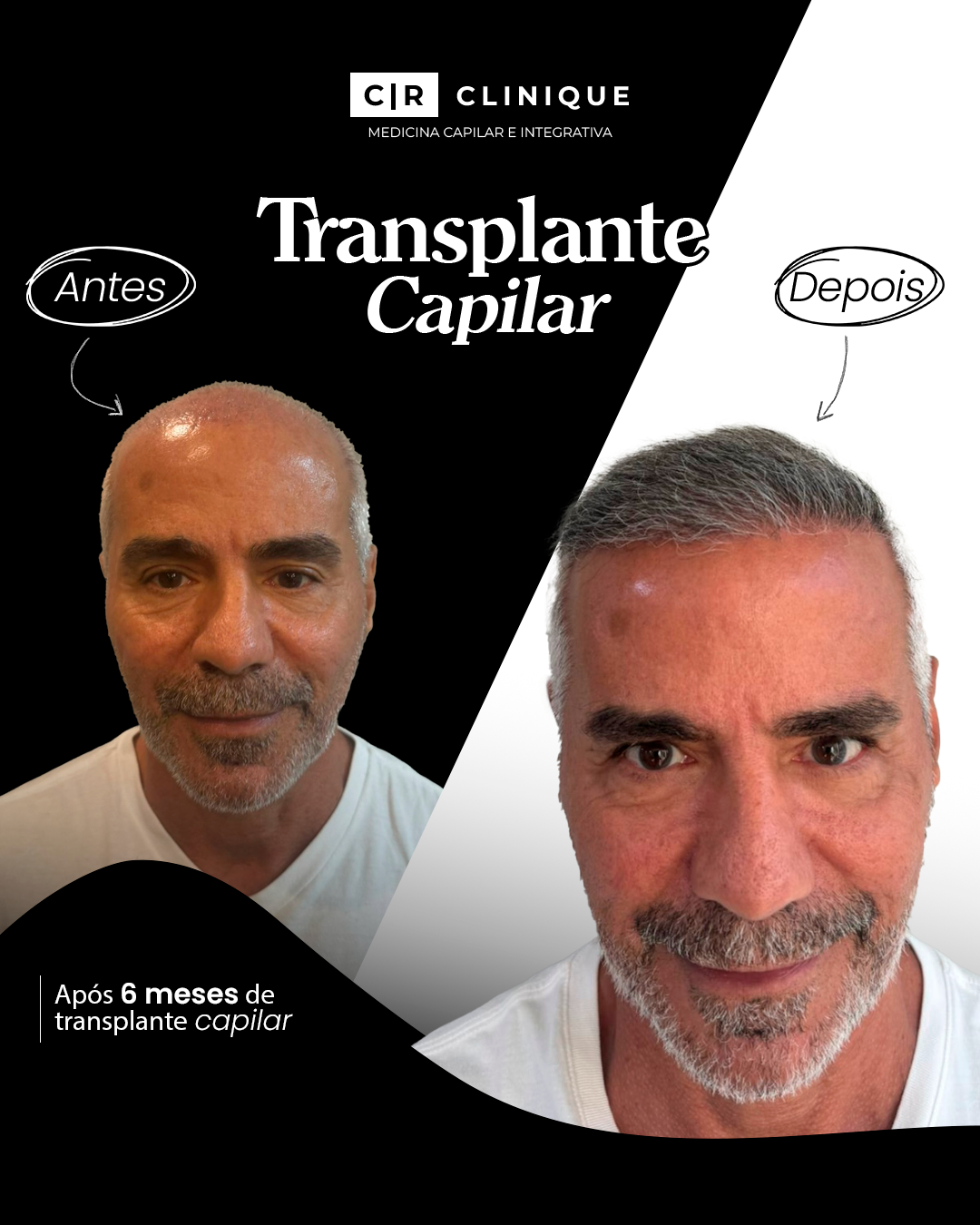 Foto de Carlos, cliente da CR Clinique.