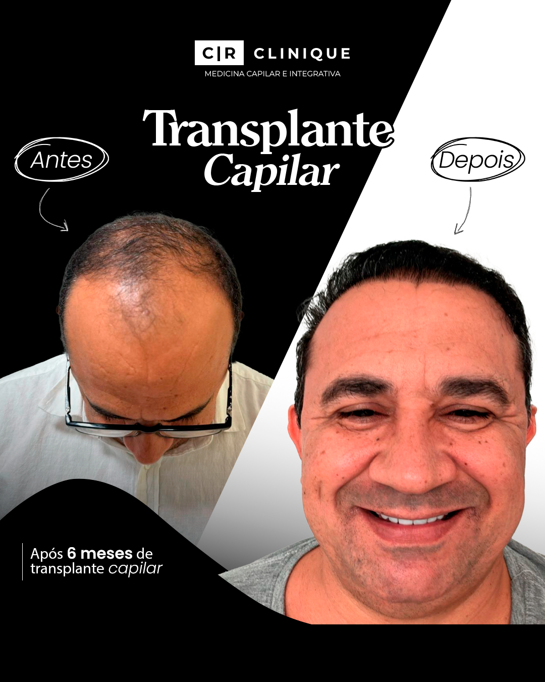 Foto de Misael, cliente da CR Clinique.