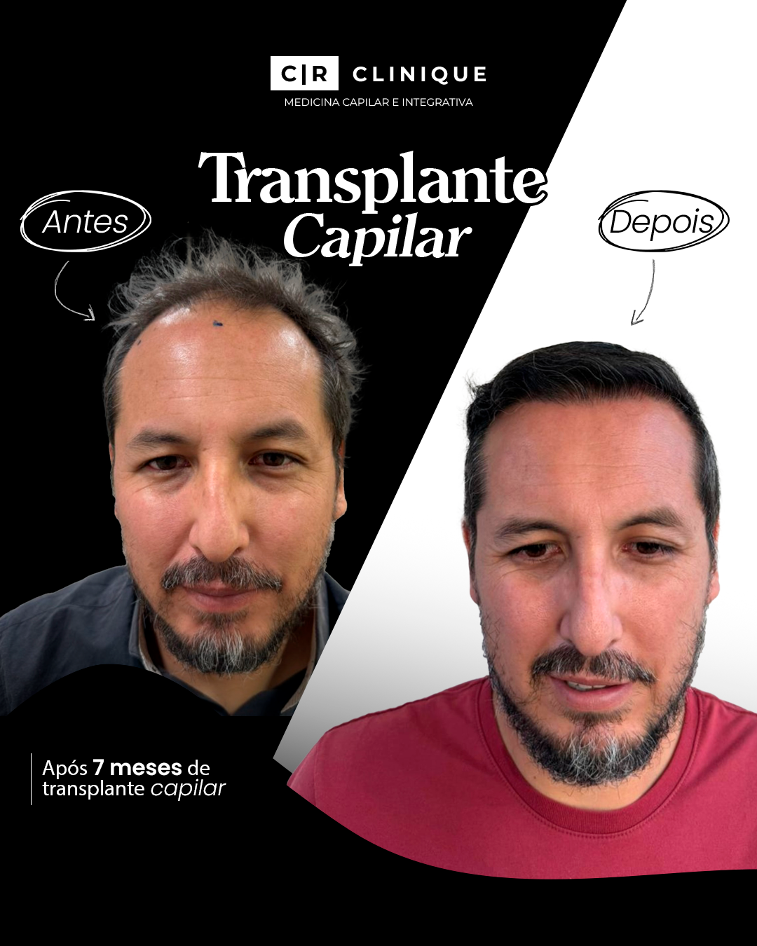 Foto de Paul, cliente da CR Clinique.