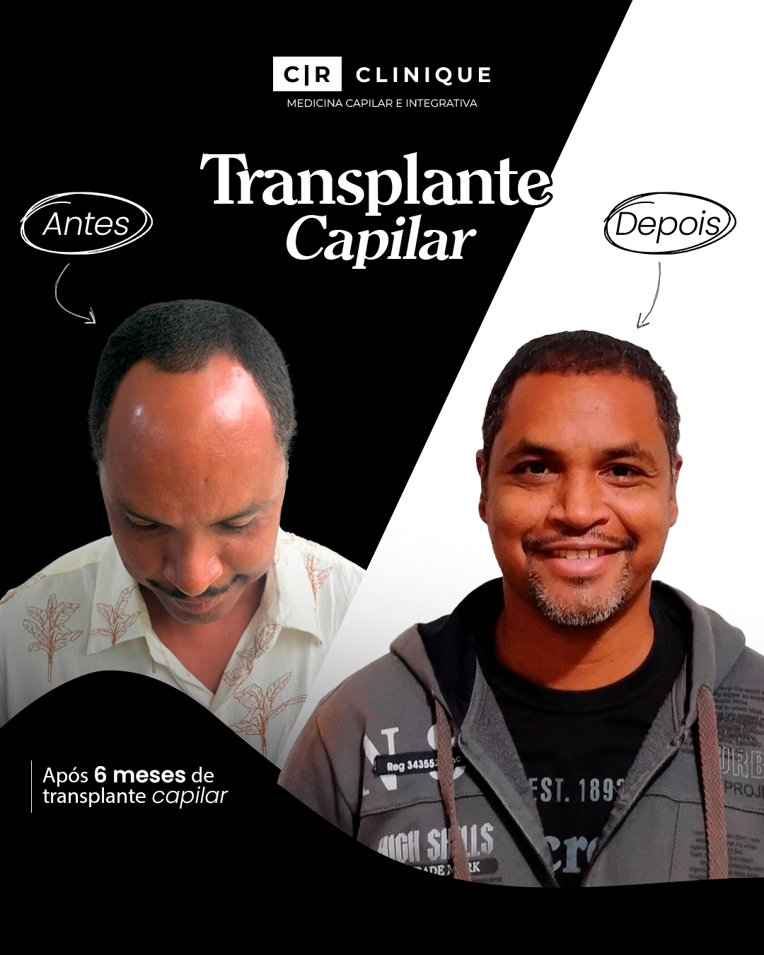 Foto de Paulo, cliente da CR Clinique.