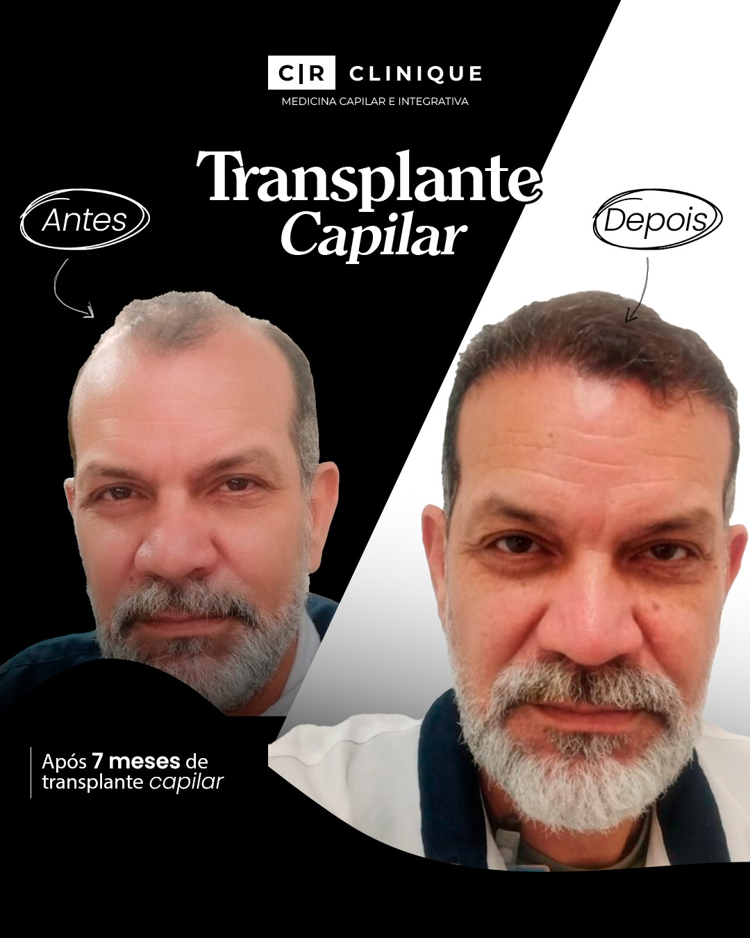 Foto de Ricardo, cliente da CR Clinique.